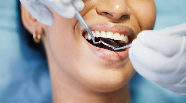 Best Broken or Cracked Tooth Emergency Dentist in Gang Mills, NY